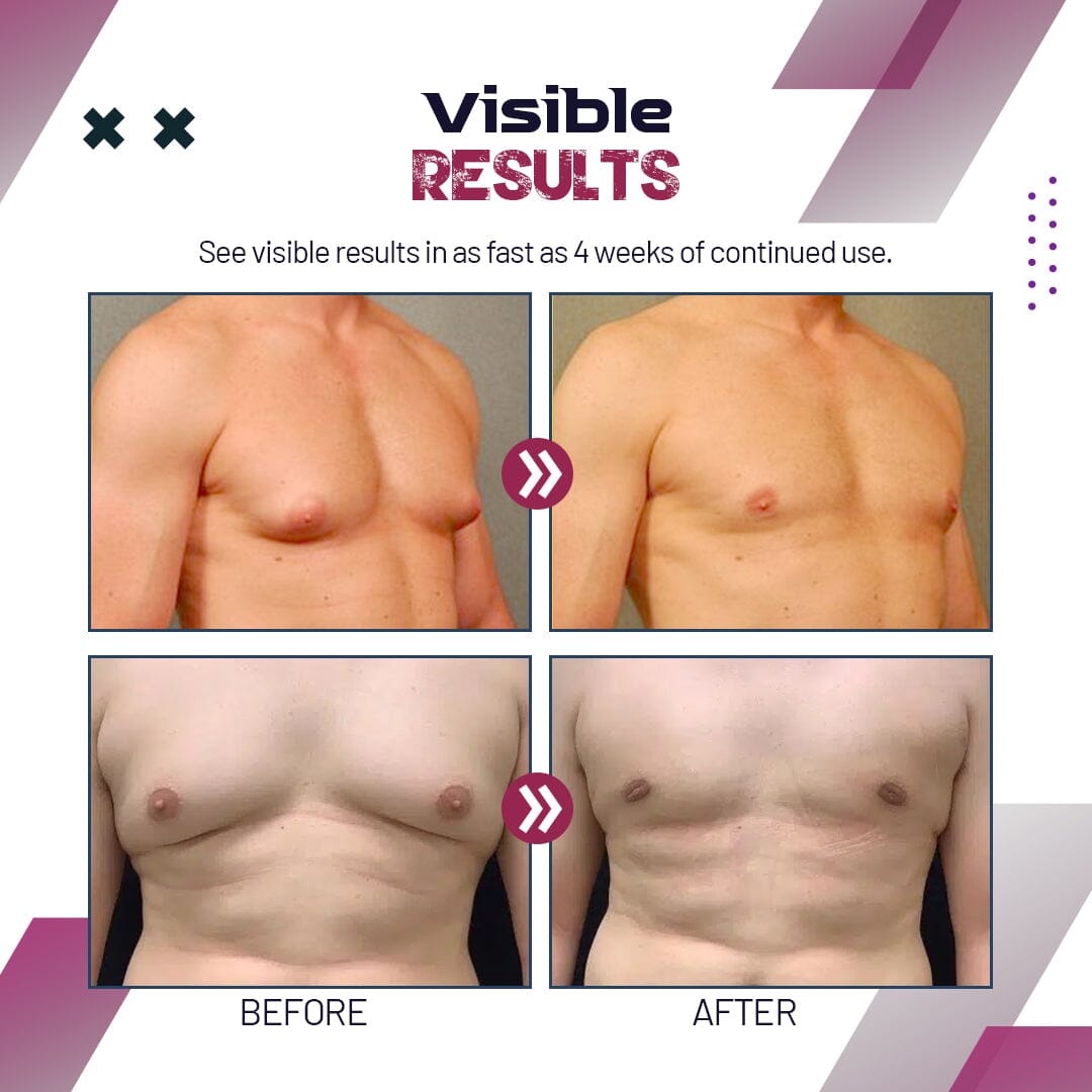 【🎌From japan🎌】SXCPOUW™ Gynecomastia Reduction Spray
