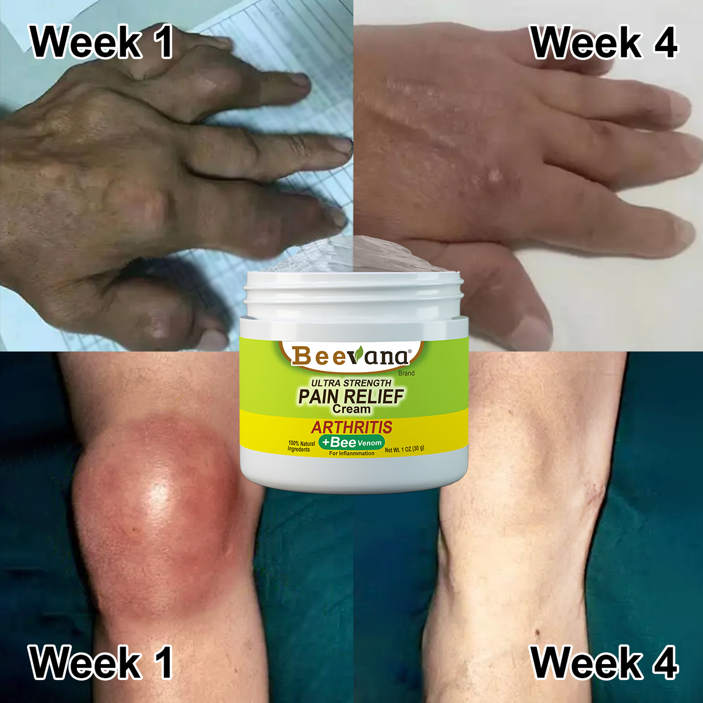 （🔥LAST DAY SALE-80% OFF) martoop™ Bee Venom Joint & Bone Therapy Cream (Full Body Recovery, Pure Natural Formula)