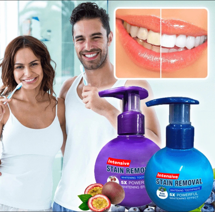 Intensive Stain Removal Whitening Toothpaste【🚚CASH ON DELIVERY + LOCAL STOCK (EXPRESS 3 DAY DELIVERY)】 TO2