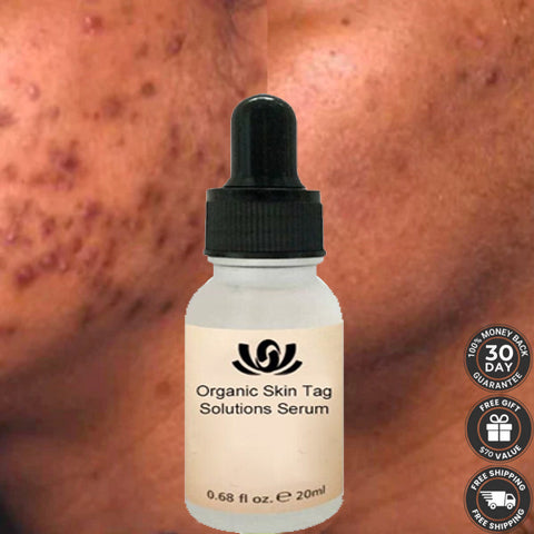 Organic Skin Spot Pigmentation Remover