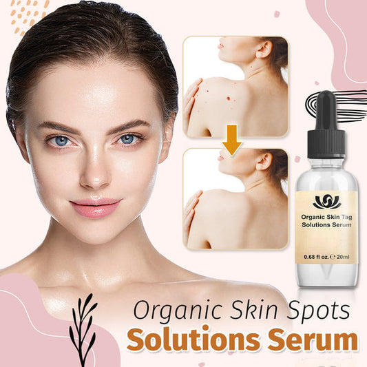 Organic Skin Spot Solutions Serum-【HOT SALE-45%OFF🔥】【Invalid refund】