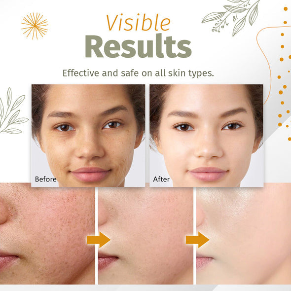 Organic Skin Spot Solutions Serum-【HOT SALE-45%OFF🔥】【Invalid refund】