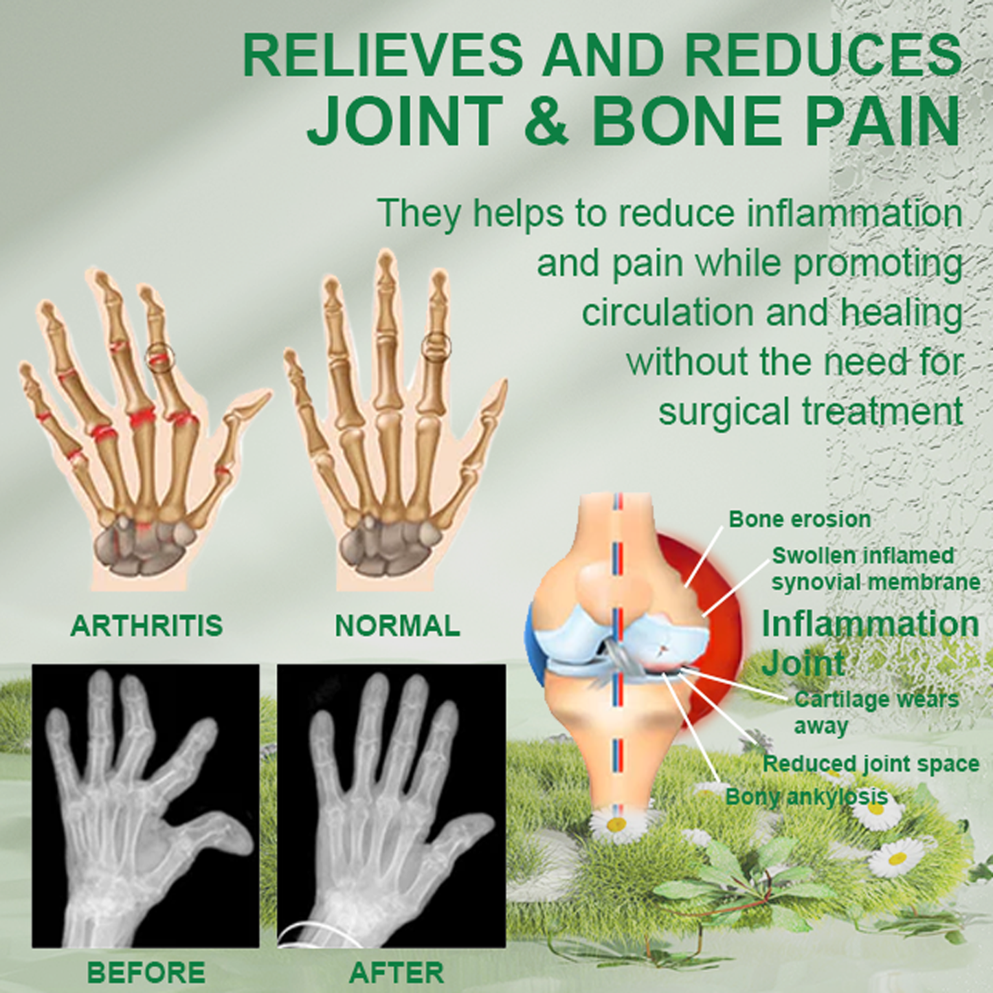 （🔥LAST DAY SALE-80% OFF) martoop™ Bee Venom Joint & Bone Therapy Cream (Full Body Recovery, Pure Natural Formula)