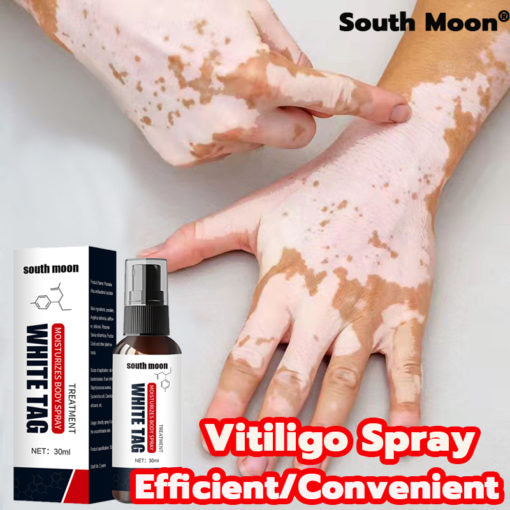 Vitiligo repair spray