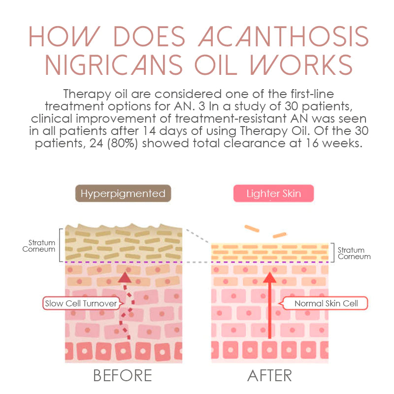 ATTDX Lightens AcanthosisNigricans TherapyOil