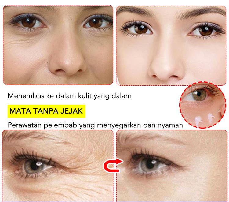 Astaxanthin Caviar Eye Cream【buy one get one free】