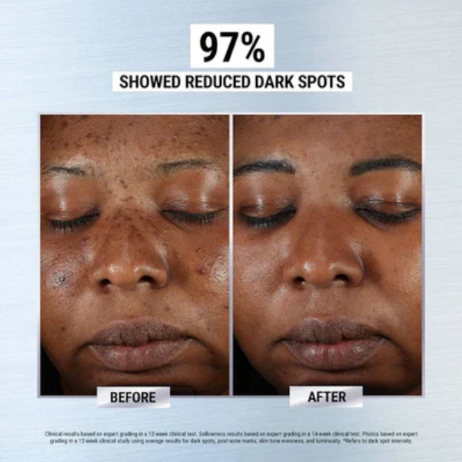 Organic Skin Spot Pigmentation Remover