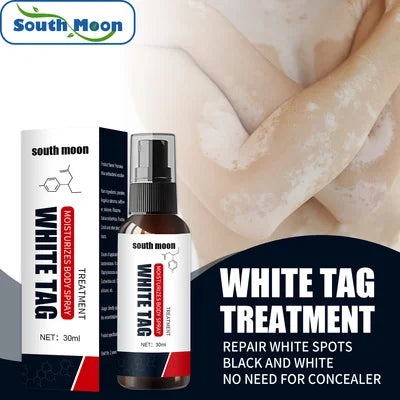 Tinea Versicolor White Spot Vitiligo Clean Spray